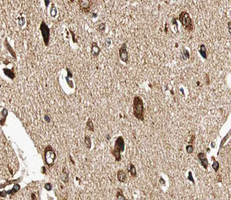 GUCY1B3 Antibody - 1:100 staining human brain tissue by IHC-P. The tissue was formaldehyde fixed and a heat mediated antigen retrieval step in citrate buffer was performed. The tissue was then blocked and incubated with the antibody for 1.5 hours at 22°C. An HRP conjugated goat anti-rabbit antibody was used as the secondary.