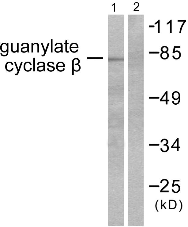 GUCY1B3 Antibody - Western blot analysis of extracts from HuvEc cells, using Guanylate Cyclase ß antibody.