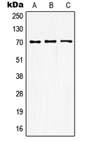 GUCY1B3 Antibody - Western blot analysis of GUCY1B3 expression in HEK293T (A); mouse kidney (B); rat kidney (C) whole cell lysates.
