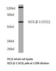 GUCY1B3 Antibody - Western blot of Guanylate Cyclase 1/3 (V21) pAb in extracts from PC12 cells.