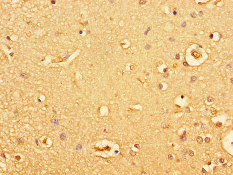 GUCY2C / Guanylyl Cyclase C Antibody - Immunohistochemistry of paraffin-embedded human brain tissue using GUCY2C Antibody at dilution of 1:100