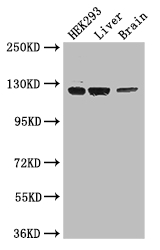 GUCY2C / Guanylyl Cyclase C Antibody - Positive WB detected in:HEK293 whole cell lysate,Mouse liver tissue,Mouse brain tissue;All lanes: GUCY2C antibody at 3.4ug/ml;Secondary;Goat polyclonal to rabbit IgG at 1/50000 dilution;Predicted band size: 124 kDa;Observed band size: 124 kDa;