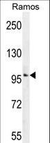 GUCY2D Antibody - GUCY2D Antibody western blot of Ramos cell line lysates (35 ug/lane). The GUCY2D antibody detected the GUCY2D protein (arrow).