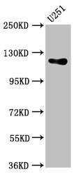 GUCY2D Antibody - Western Blot Positive WB detected in: U251 whole cell lysate All lanes: GUCY2D antibody at 5.4µg/ml Secondary Goat polyclonal to rabbit IgG at 1/50000 dilution Predicted band size: 121 kDa Observed band size: 121 kDa