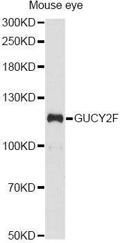 GUCY2F Antibody - Western blot analysis of extracts of mouse eye, using GUCY2F antibody at 1:1000 dilution. The secondary antibody used was an HRP Goat Anti-Rabbit IgG (H+L) at 1:10000 dilution. Lysates were loaded 25ug per lane and 3% nonfat dry milk in TBST was used for blocking. An ECL Kit was used for detection and the exposure time was 90s.