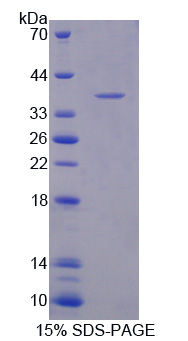 AIF1 / IBA1 Protein - Recombinant Allograft Inflammatory Factor 1 By SDS-PAGE