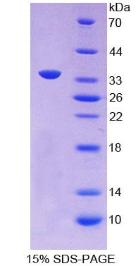 APOC2 / Apolipoprotein C II Protein - Recombinant  Apolipoprotein C2 By SDS-PAGE
