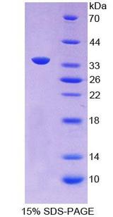APOC2 / Apolipoprotein C II Protein - Recombinant  Apolipoprotein C2 By SDS-PAGE