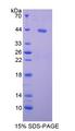 BDNF Protein - Recombinant Brain Derived Neurotrophic Factor By SDS-PAGE