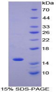 CCL2 / MCP1 Protein - Recombinant Monocyte Chemotactic Protein 1 By SDS-PAGE