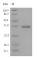 CD46 Protein - (Tris-Glycine gel) Discontinuous SDS-PAGE (reduced) with 5% enrichment gel and 15% separation gel.