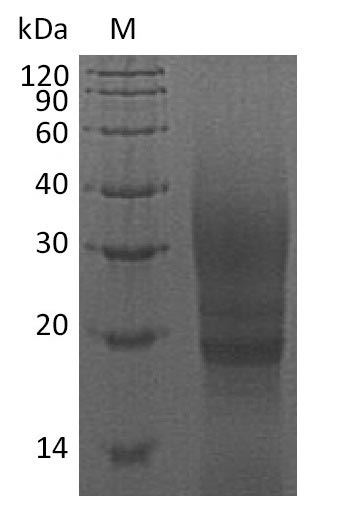 CTLA4 / CD152 Protein - (Tris-Glycine gel) Discontinuous SDS-PAGE (reduced) with 5% enrichment gel and 15% separation gel.