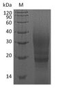 CTLA4 / CD152 Protein - (Tris-Glycine gel) Discontinuous SDS-PAGE (reduced) with 5% enrichment gel and 15% separation gel.