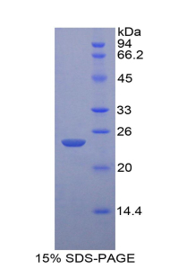 IL-1B / IL-1 Beta Protein - Recombinant Interleukin 1 Beta By SDS-PAGE