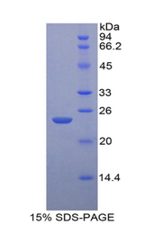 IL-1B / IL-1 Beta Protein - Recombinant Interleukin 1 Beta By SDS-PAGE