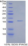 IL15 Protein - Recombinant Interleukin 15 By SDS-PAGE