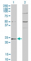 GUK1 / Guanylate Kinase 1 Antibody - Western blot of GUK1 in 1) transfected 293T cells and 2) untransfected 293T cells using GUK1 / Guanylate Kinase 1 Antibody at 1:500.