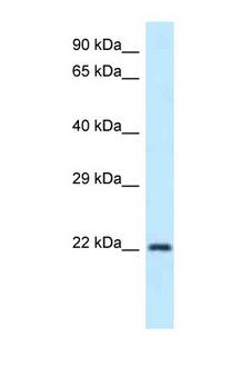 GUK1 / Guanylate Kinase 1 Antibody - GUK1 antibody Western blot of Rat Muscle lysate. Antibody concentration 1 ug/ml.  This image was taken for the unconjugated form of this product. Other forms have not been tested.