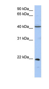GUK1 / Guanylate Kinase 1 Antibody - GUK1 antibody Western blot of Fetal Kidney lysate. This image was taken for the unconjugated form of this product. Other forms have not been tested.