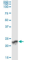 GUK1 / Guanylate Kinase 1 Antibody - Immunoprecipitation of GUK1 transfected lysate using anti-GUK1 monoclonal antibody and Protein A Magnetic Bead, and immunoblotted with GUK1 rabbit polyclonal antibody.