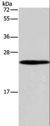 GUK1 / Guanylate Kinase 1 Antibody - Western blot analysis of 231 cell, using GUK1 Polyclonal Antibody at dilution of 1:400.