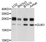GUK1 / Guanylate Kinase 1 Antibody - Western blot analysis of extracts of various cells.