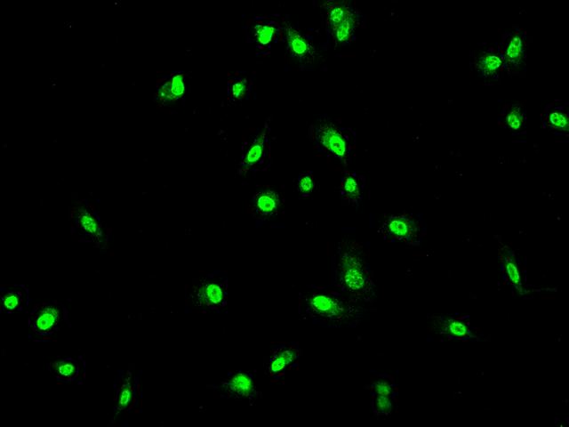 GUK1 / Guanylate Kinase 1 Antibody - Immunofluorescence staining of GUK1 in PC3 cells. Cells were fixed with 4% PFA, permeabilzed with 0.1% Triton X-100 in PBS, blocked with 10% serum, and incubated with rabbit anti-Human GUK1 polyclonal antibody (dilution ratio 1:200) at 4°C overnight. Then cells were stained with the Alexa Fluor 488-conjugated Goat Anti-rabbit IgG secondary antibody (green). Positive staining was localized to Nucleus.