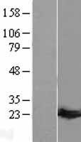 GUK1 / Guanylate Kinase 1 Protein - Western validation with an anti-DDK antibody * L: Control HEK293 lysate R: Over-expression lysate