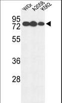GUSB / Beta Glucuronidase Antibody - Western blot of GUSB Antibody in WiDr, A2058, K562 cell line lysates (35 ug/lane). GUSB (arrow) was detected using the purified antibody.