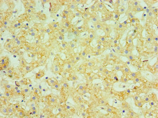 GUSB / Beta Glucuronidase Antibody - Immunohistochemistry of paraffin-embedded human liver tissue using GUSB Antibody at dilution of 1:100