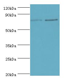 GUSB / Beta Glucuronidase Antibody - Western blot. All lanes: AGUSB antibody at 2 ug/ml. Lane 1: HL-60 whole cell lysate. Lane 2: HepG2 whole cell lysate. Secondary antibody: Goat polyclonal to rabbit at 1:10000 dilution. Predicted band size: 75 kDa. Observed band size: 75 kDa.