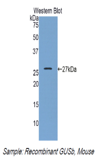 GUSB / Beta Glucuronidase Antibody - Western blot of recombinant GUSB / BG / Beta Glucuronidase.  This image was taken for the unconjugated form of this product. Other forms have not been tested.