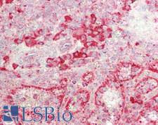 GUSB / Beta Glucuronidase Antibody - Human Spleen: Formalin-Fixed, Paraffin-Embedded (FFPE)
