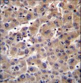 GUSB / Beta Glucuronidase Antibody - GUSB Antibody immunohistochemistry of formalin-fixed and paraffin-embedded human liver tissue followed by peroxidase-conjugated secondary antibody and DAB staining.