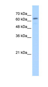GUSB / Beta Glucuronidase Antibody - GUSB antibody ARP44234_T100-NP_000172-GUSB(glucuronidase, beta) Antibody Western blot of HepG2 cell lysate.  This image was taken for the unconjugated form of this product. Other forms have not been tested.