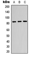 GUSB / Beta Glucuronidase Antibody - Western blot analysis of Beta-glucuronidase expression in K562 (A); HeLa (B); HepG2 (C) whole cell lysates.