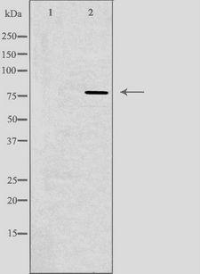 GUSB / Beta Glucuronidase Antibody - Western blot analysis of extracts of HeLa cells using GUSB antibody. The lane on the left is treated with the antigen-specific peptide.