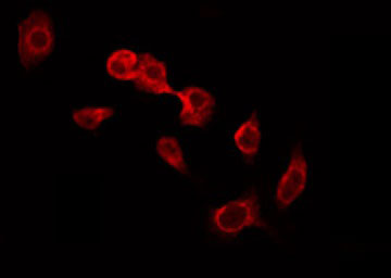 GUSB / Beta Glucuronidase Antibody - Staining HeLa cells by IF/ICC. The samples were fixed with PFA and permeabilized in 0.1% Triton X-100, then blocked in 10% serum for 45 min at 25°C. The primary antibody was diluted at 1:200 and incubated with the sample for 1 hour at 37°C. An Alexa Fluor 594 conjugated goat anti-rabbit IgG (H+L) Ab, diluted at 1/600, was used as the secondary antibody.