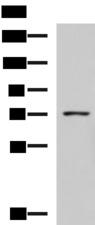GUSB / Beta Glucuronidase Antibody - Western blot analysis of K562 cell lysate  using GUSB Polyclonal Antibody at dilution of 1:800