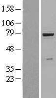 GUSB / Beta Glucuronidase Protein - Western validation with an anti-DDK antibody * L: Control HEK293 lysate R: Over-expression lysate