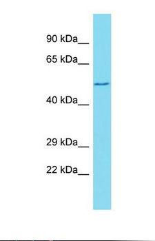 GXYLT1 Antibody - Western blot of Human Jurkat. GXYLT1 antibody dilution 1.0 ug/ml.  This image was taken for the unconjugated form of this product. Other forms have not been tested.