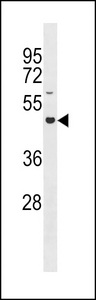 GXYLT2 Antibody - GLT8D4 Antibody western blot of SK-BR-3 cell line lysates (35 ug/lane). The GLT8D4 antibody detected the GLT8D4 protein (arrow).