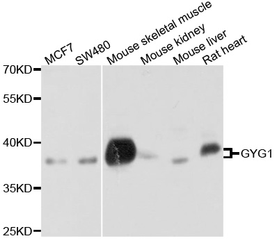 GYG1 / Glycogenin Antibody - Western blot analysis of extracts of various cell lines, using GYG1 antibody at 1:1000 dilution. The secondary antibody used was an HRP Goat Anti-Rabbit IgG (H+L) at 1:10000 dilution. Lysates were loaded 25ug per lane and 3% nonfat dry milk in TBST was used for blocking. An ECL Kit was used for detection and the exposure time was 5s.