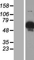 GYG2 Protein - Western validation with an anti-DDK antibody * L: Control HEK293 lysate R: Over-expression lysate