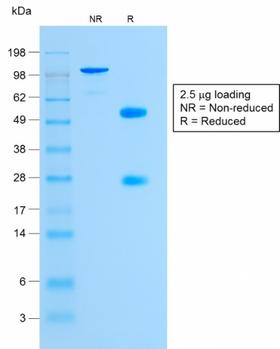 GYPA / CD235a / Glycophorin A Antibody - SDS-PAGE Analysis Purified Glycophorin A Rabbit Monoclonal Antibody (GYPA/1725R). Confirmation of Purity and Integrity of Antibody.
