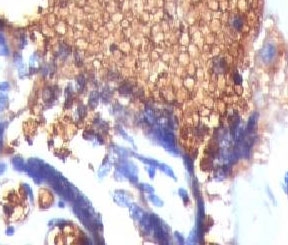 GYPA / CD235a / Glycophorin A Antibody - IHC testing of FFPE human placenta and Glycophorin A antibody (GYPA/280).  This image was taken for the unmodified form of this product. Other forms have not been tested.