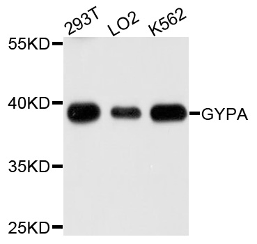 GYPA / CD235a / Glycophorin A Antibody - Western blot analysis of extracts of various cells.
