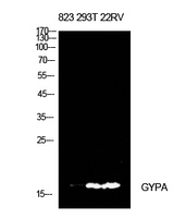 GYPA / CD235a / Glycophorin A Antibody - Western Blot analysis of extracts from 823, 293T, 22RV cells using GYPA Antibody.