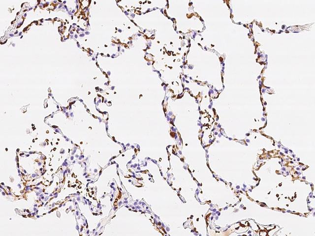 GYPA / CD235a / Glycophorin A Antibody - Immunochemical staining of human GYPA in human lung with rabbit polyclonal antibody at 1:1000 dilution, formalin-fixed paraffin embedded sections.