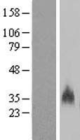 GYPB / CD235b / Glycophorin B Protein - Western validation with an anti-DDK antibody * L: Control HEK293 lysate R: Over-expression lysate